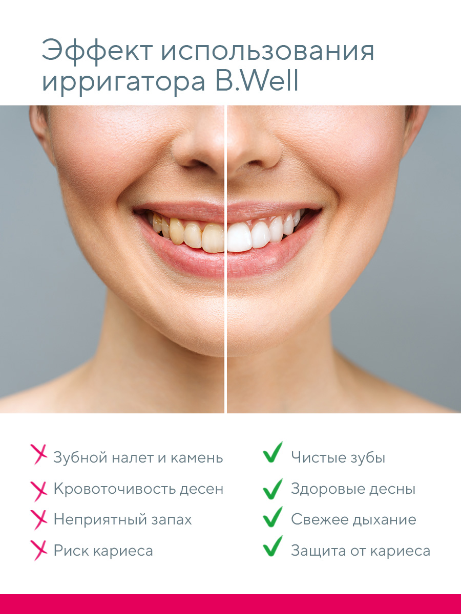 Ирригатор B.Well импульсный 4 реж. - фото 11