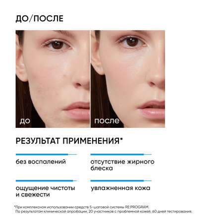 Тоник ICON SKIN ultra skin 150 мл