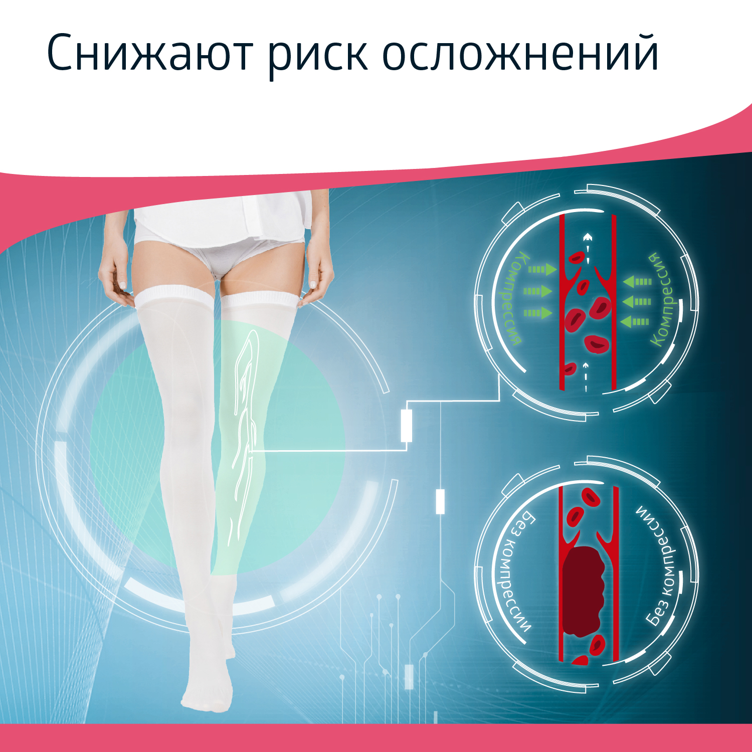 Чулки B.Well JW-214 размер 1 антиэмболические госпитальные 1 класс компрессии - фото 12