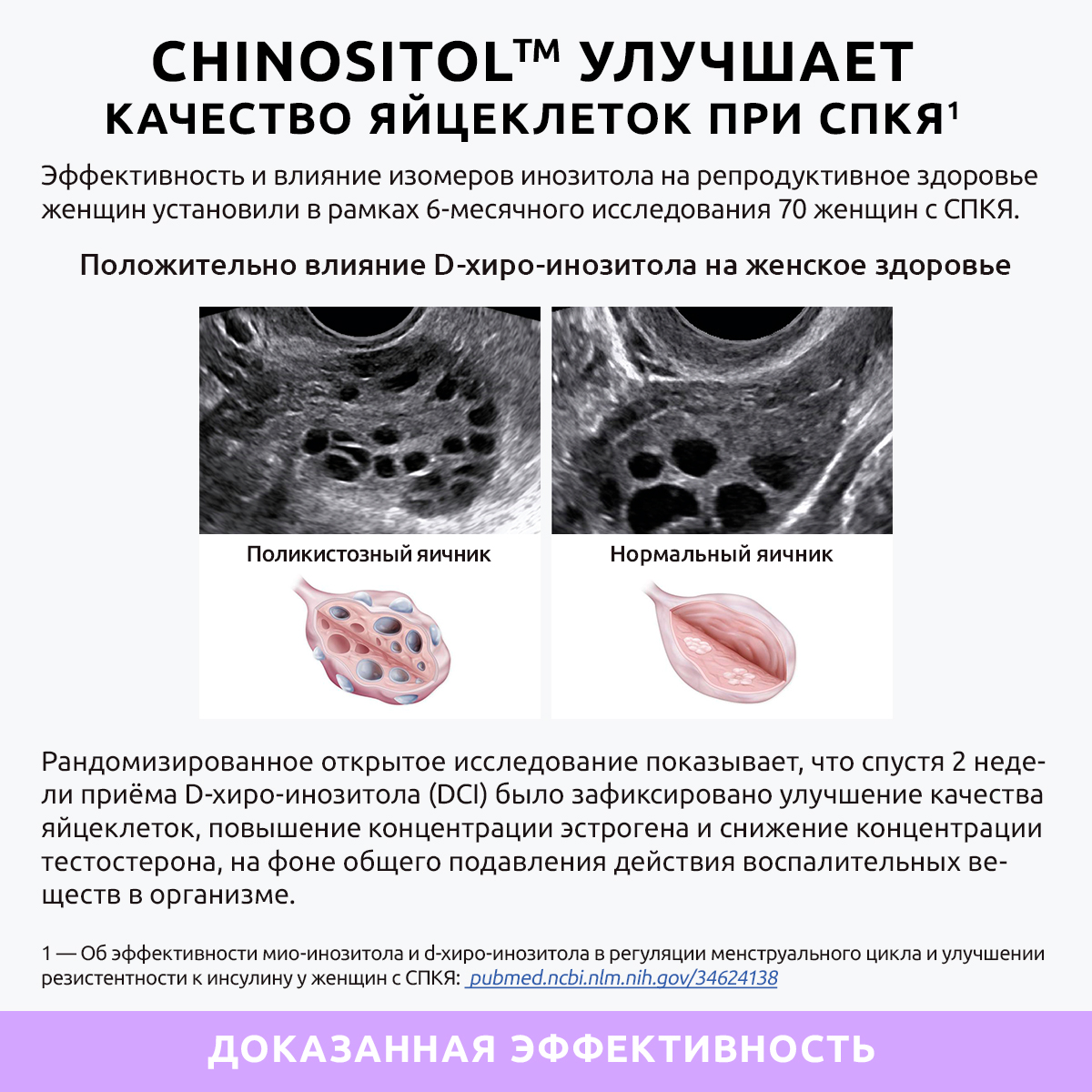 Инозитол витамин 1000 мг капсулы UltraBalance бад комплекс для женского здоровья миоинозитол для женщин и мужчин 120 капсул - фото 9