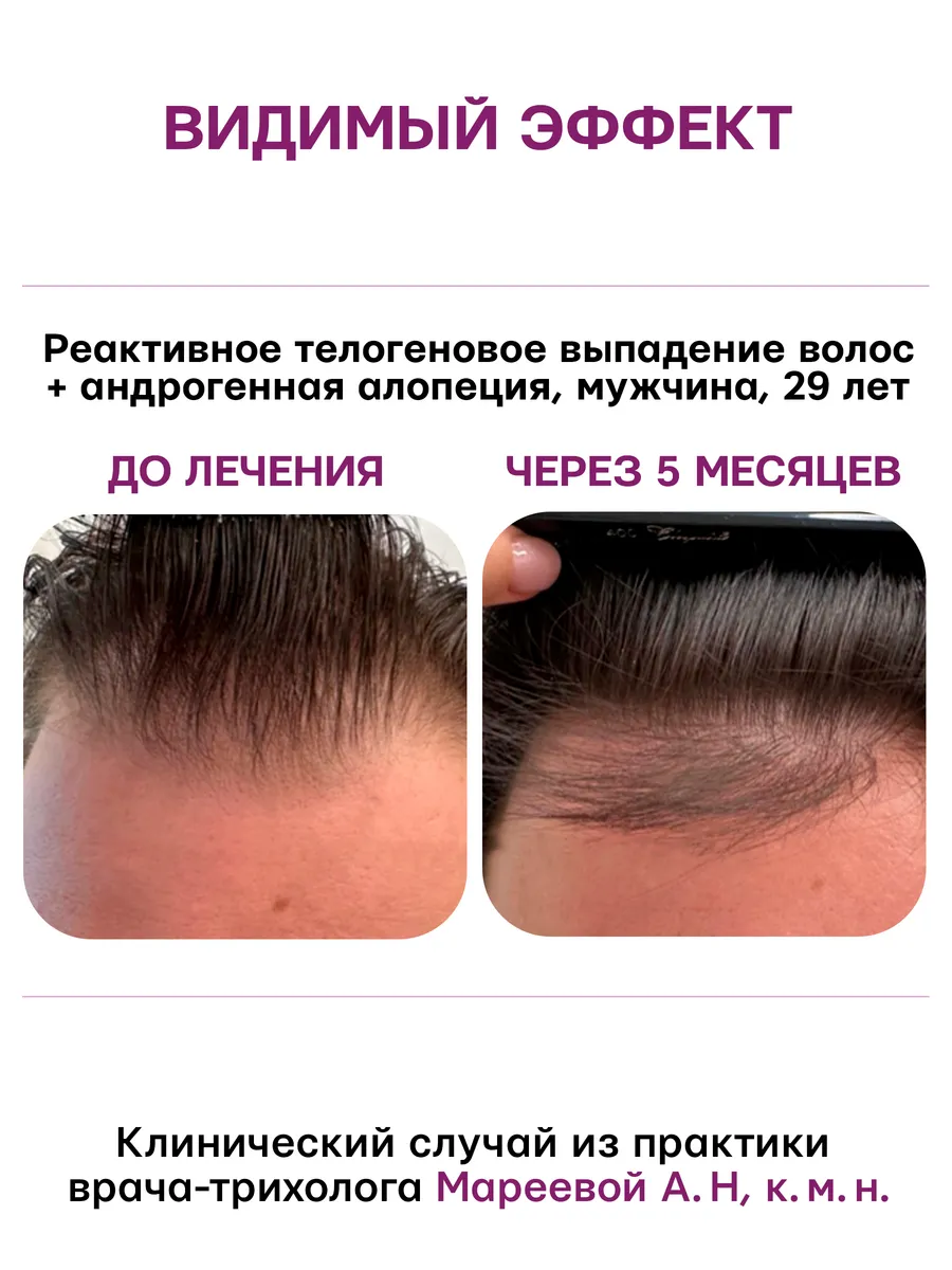 Сыворотка Селенцин 100 мл 1 шт. - фото 11