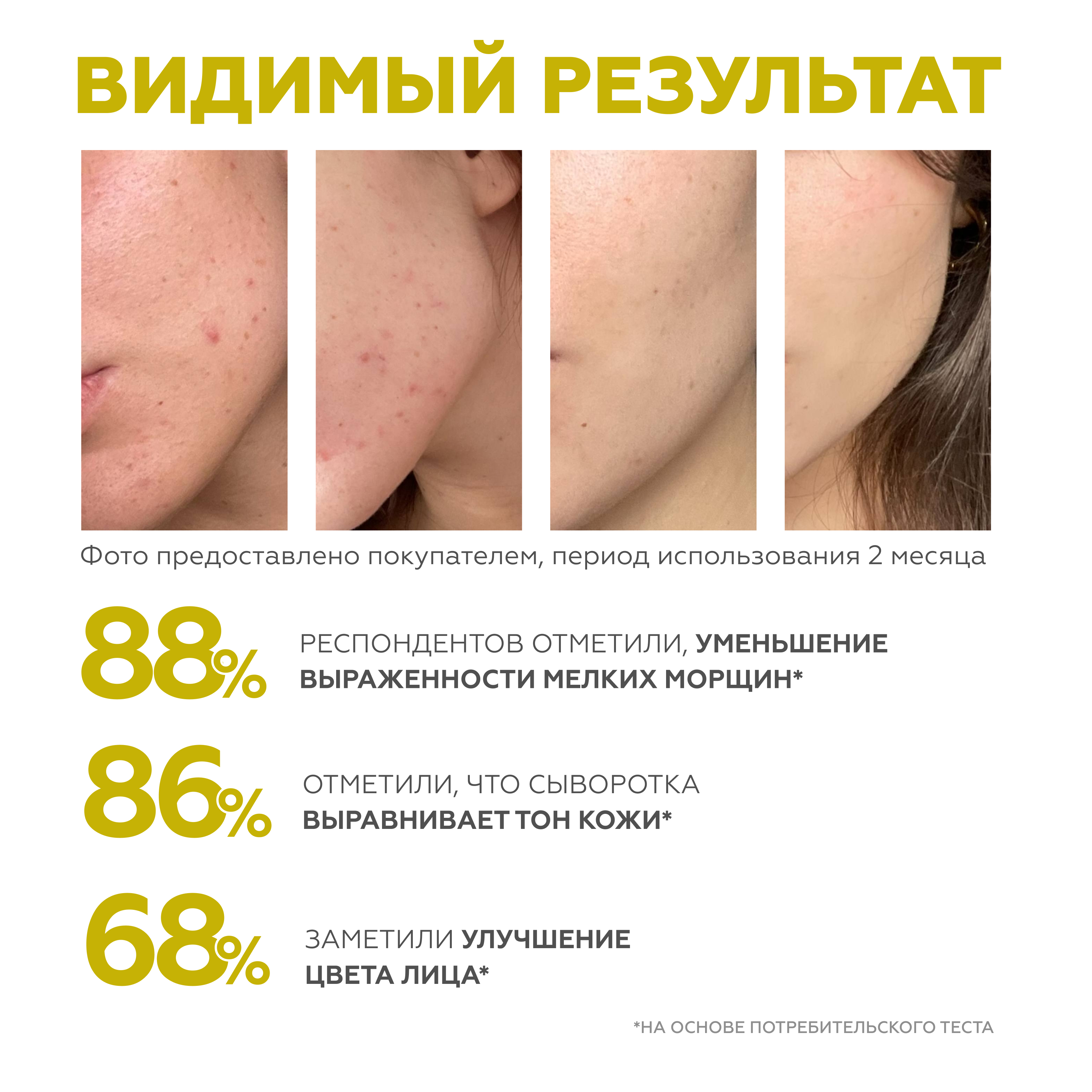 Сыворотка GELTEK 30 мл - фото 4