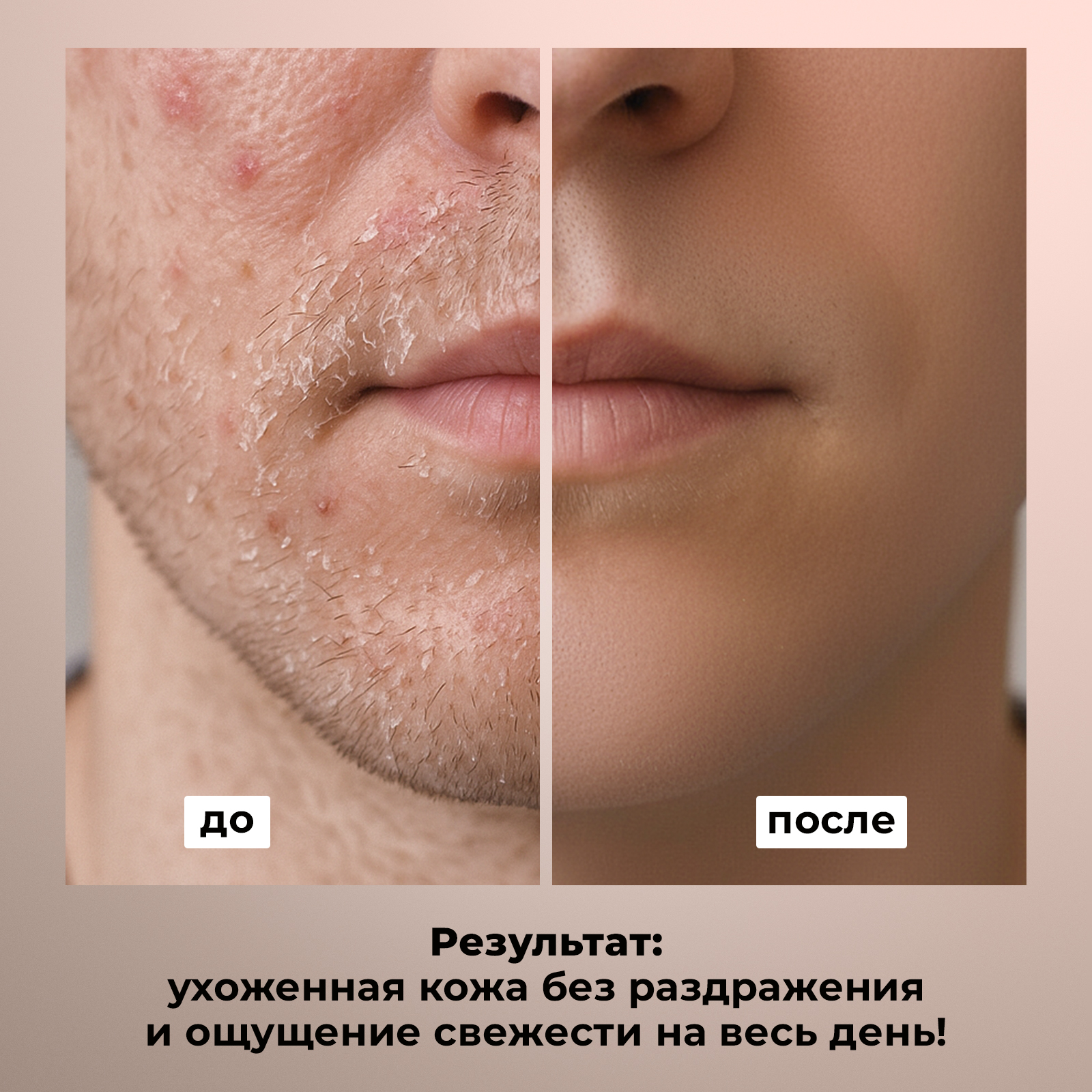 Крем после бритья NUZHNOE против раздражения 200 мл - фото 2