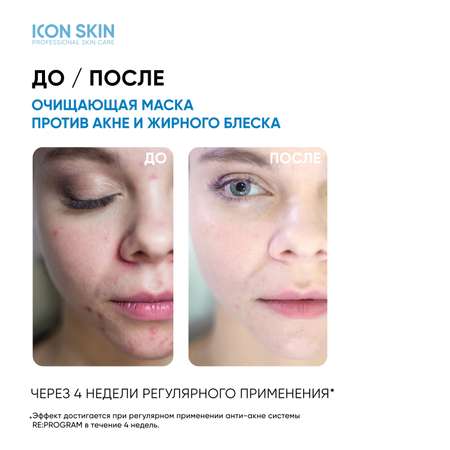 Маска ICON SKIN