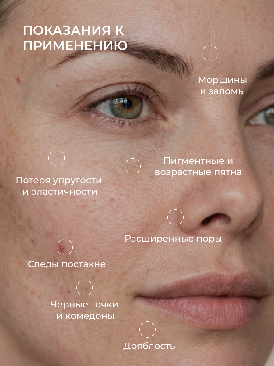 Сыворотка АКАВИЯ С микроиглами и ретинолом - фото 3