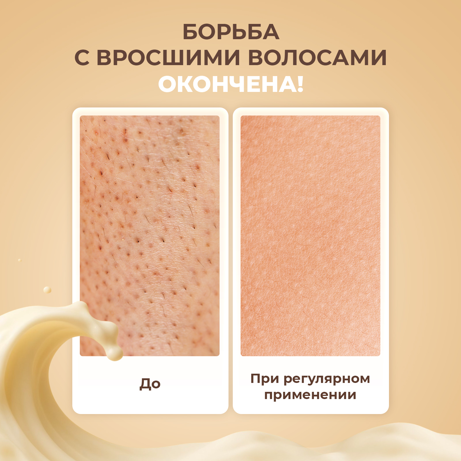 Крем после депиляции YesMix от вросших волос и раздражения, 200 мл - фото 3
