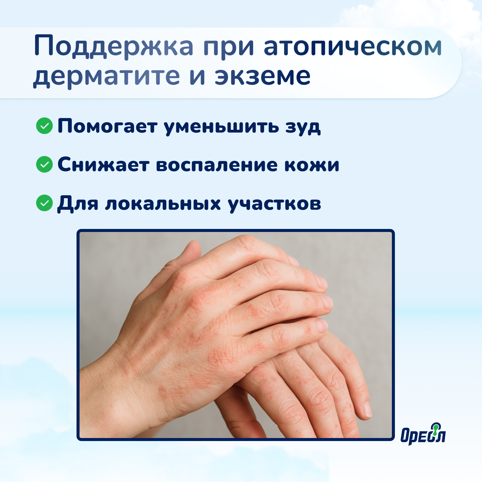 Ультрафиолетовая лампа Ореол Здоровья ОУФК-311 - фото 9