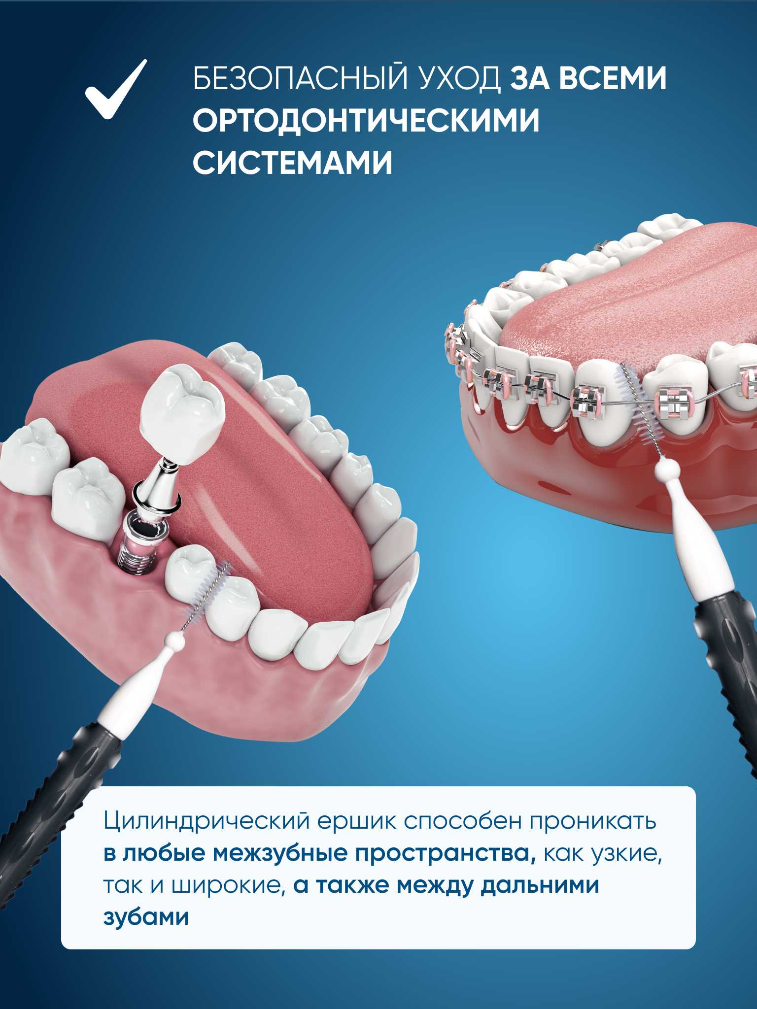 Зубная нить PECHAM - фото 4