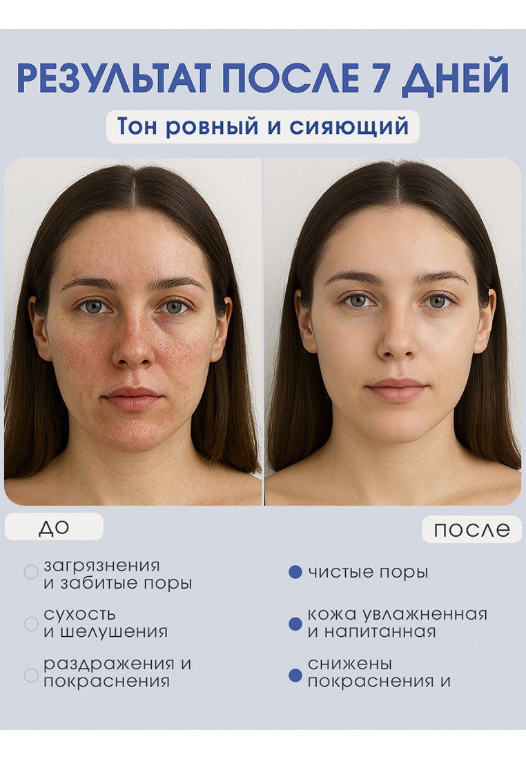 Мусс Camomilla BLU 100 мл 1 шт. - фото 5