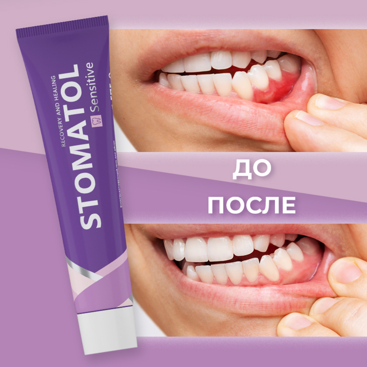 Зубной гель STOMATOL - фото 4