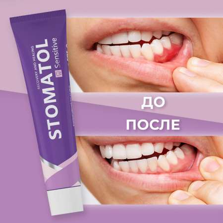 Зубной гель STOMATOL