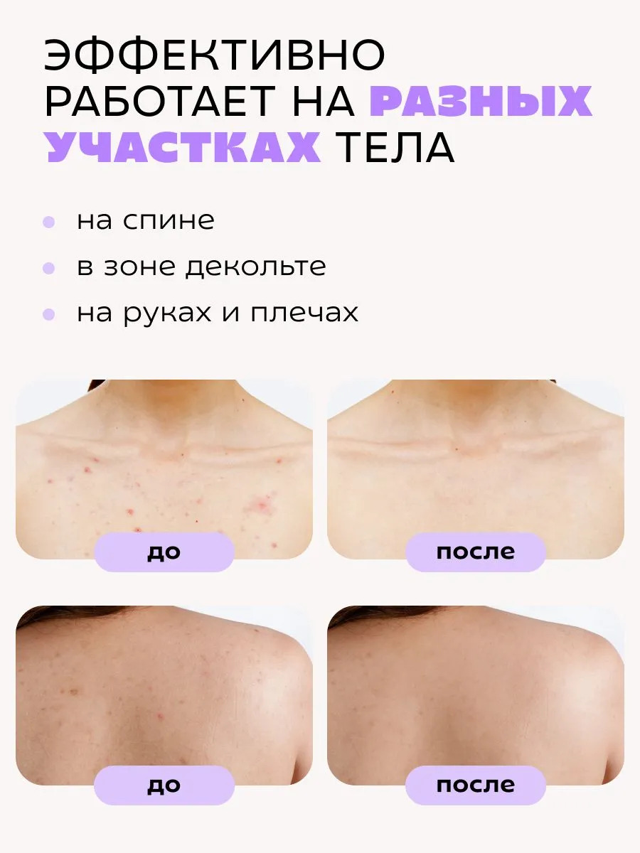 Сыворотка Краснополянская косметика Муцин и Ниацинамид 30 мл 2 шт. - фото 12