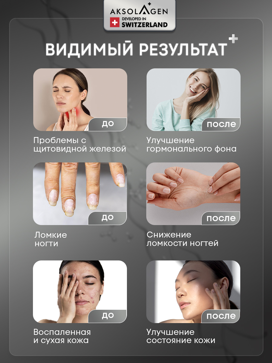 Морской коллаген 1 2 3 типа AKSOLAGEN с экстрактом кокосового молока - фото 10