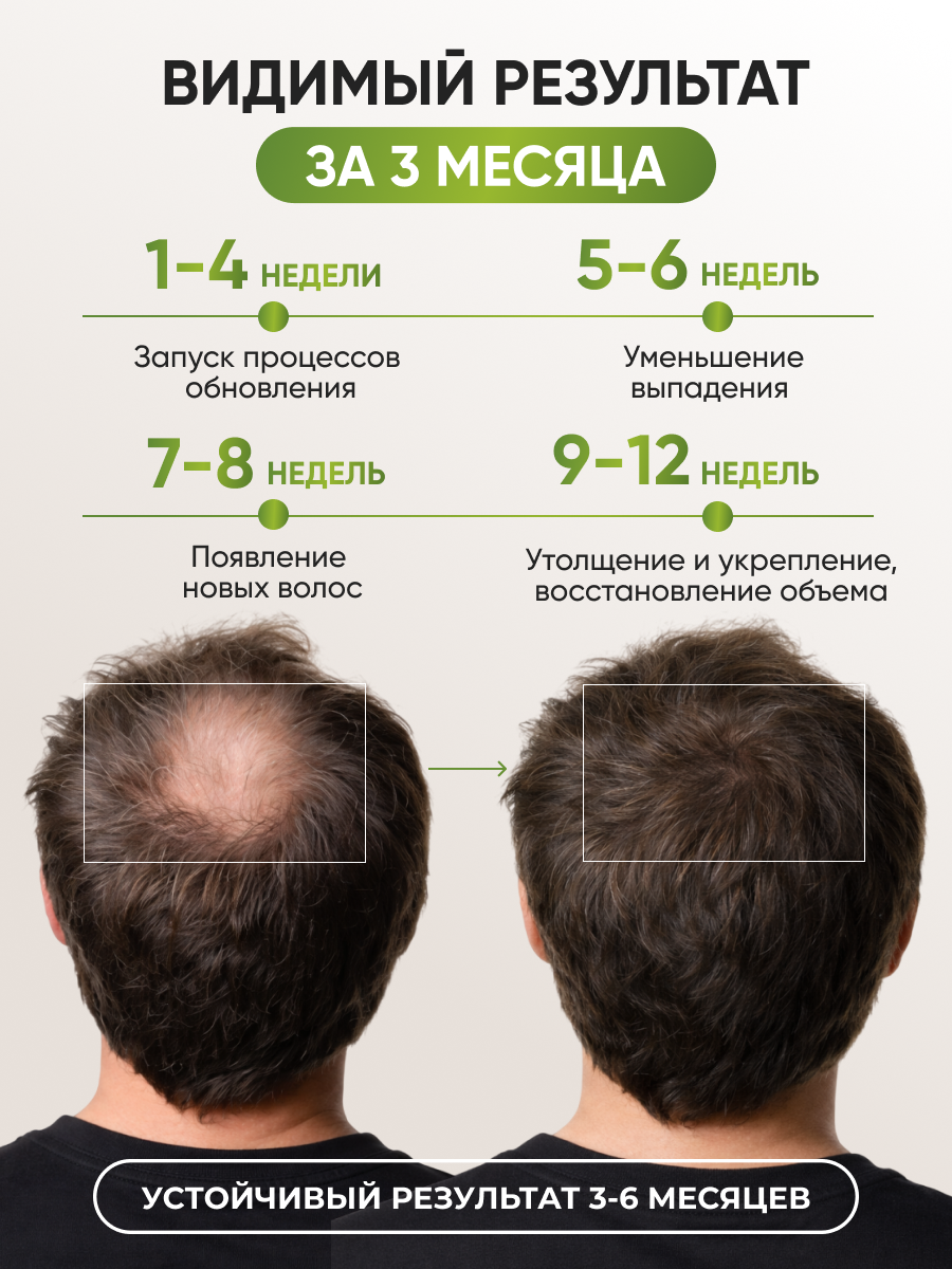 Лосьон Ринфолтил 100 мл - фото 3