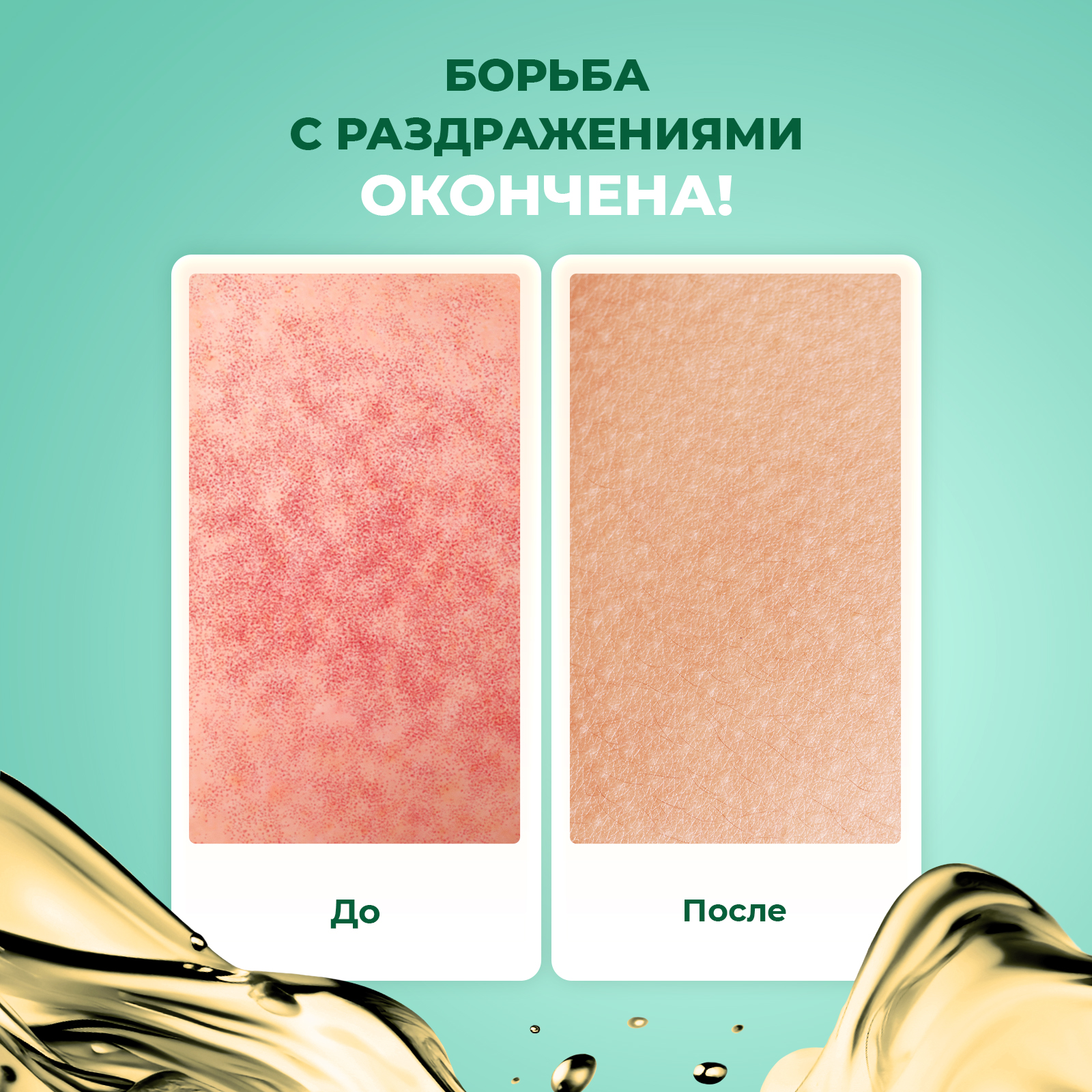 Гель для бритья YesMix 200 мл - фото 2