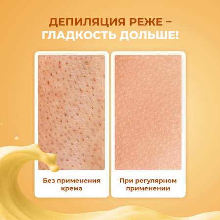 Крем после депиляции YesMix для замедления роста волос, 200 мл