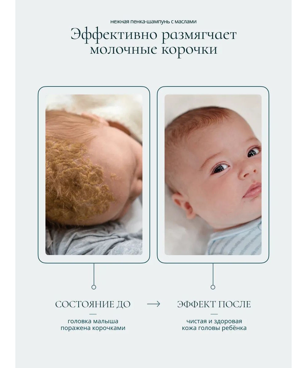 Шампунь Baby Balance от молочных корочек 250 мл - фото 7