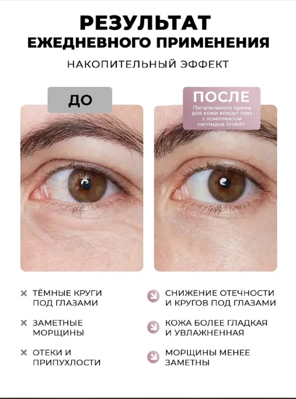 Крем SHARY для кожи вокруг глаз 30 мл - фото 3