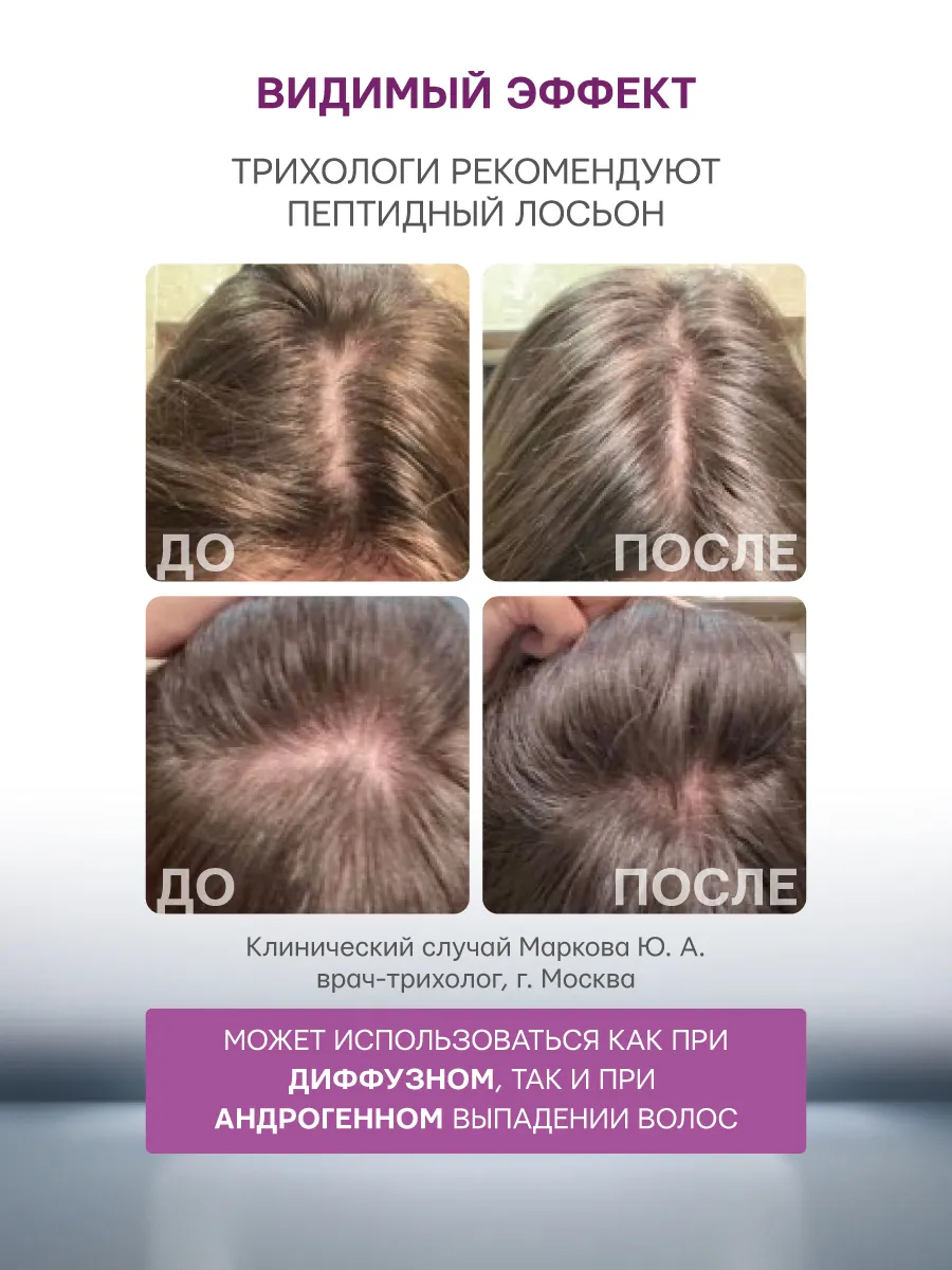 Лосьон Селенцин 75 мл 1 шт. - фото 8