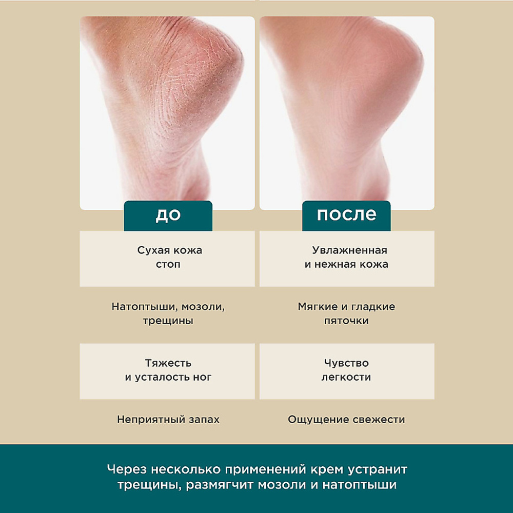 Крем PERFECT4U для ног увлажняющий 100 мл - фото 3