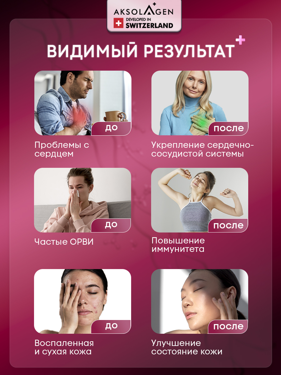 Морской коллаген 1 2 3 типа AKSOLAGEN с экстрактом шиповником - фото 10