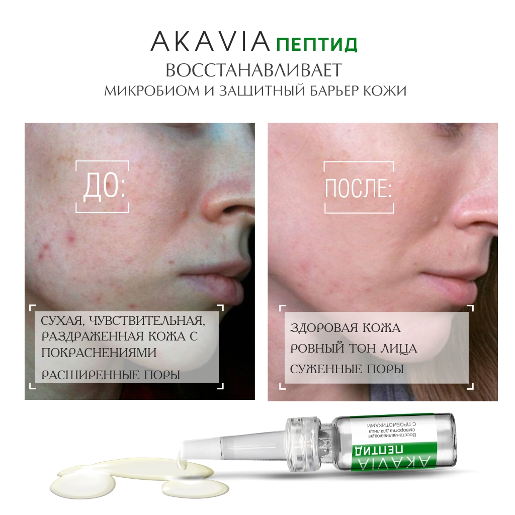 Сыворотка АКАВИЯ Peptide Восстанавливающая - фото 6