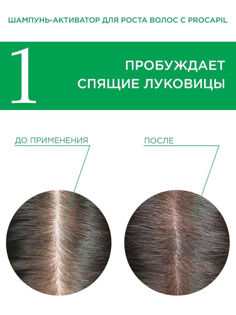 Набор средств HydroBionique by Doctor Ocean 450 мл 450 мл 2 шт. - фото 9