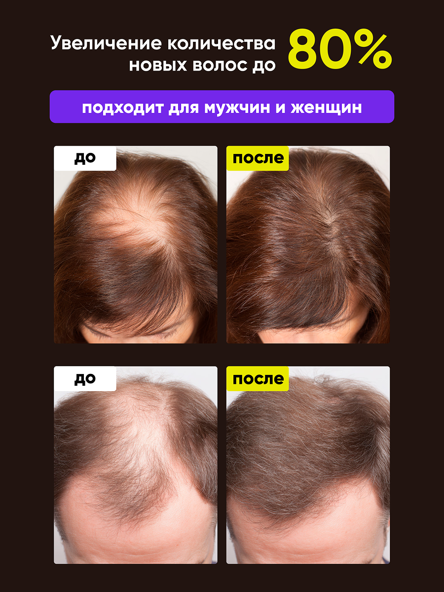 Спрей qeep 100 мл 1 шт. - фото 7
