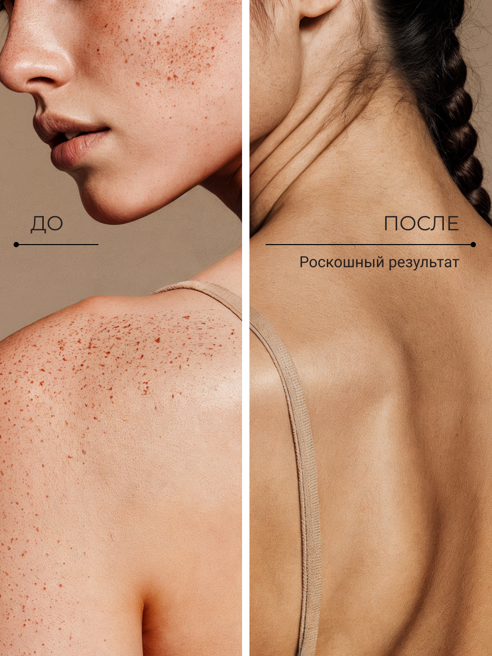 Солнцезащитный спрей Zeitun для лица и тела SPF30 увлажняющий, 200 мл - фото 10
