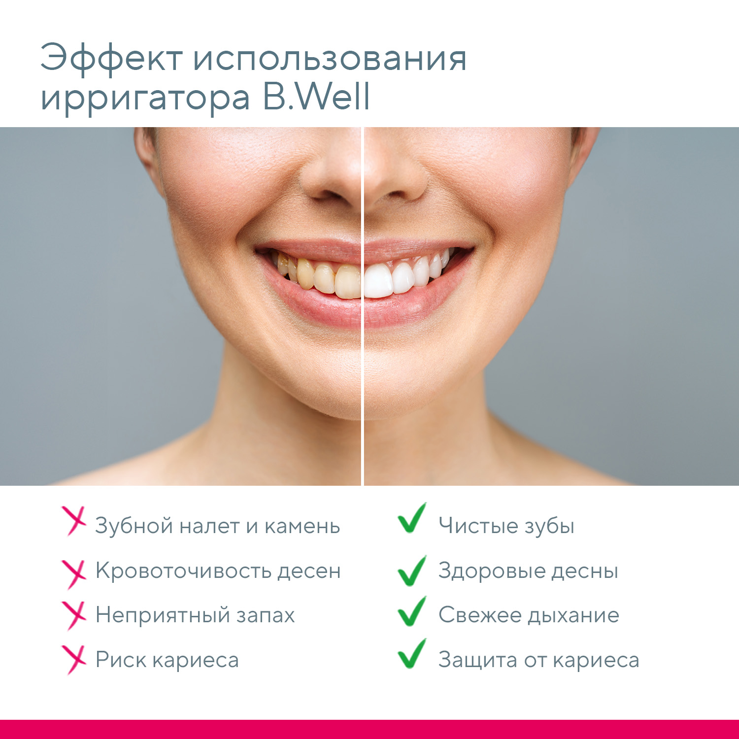 Ирригатор B.Well импульсный 4 реж. - фото 12