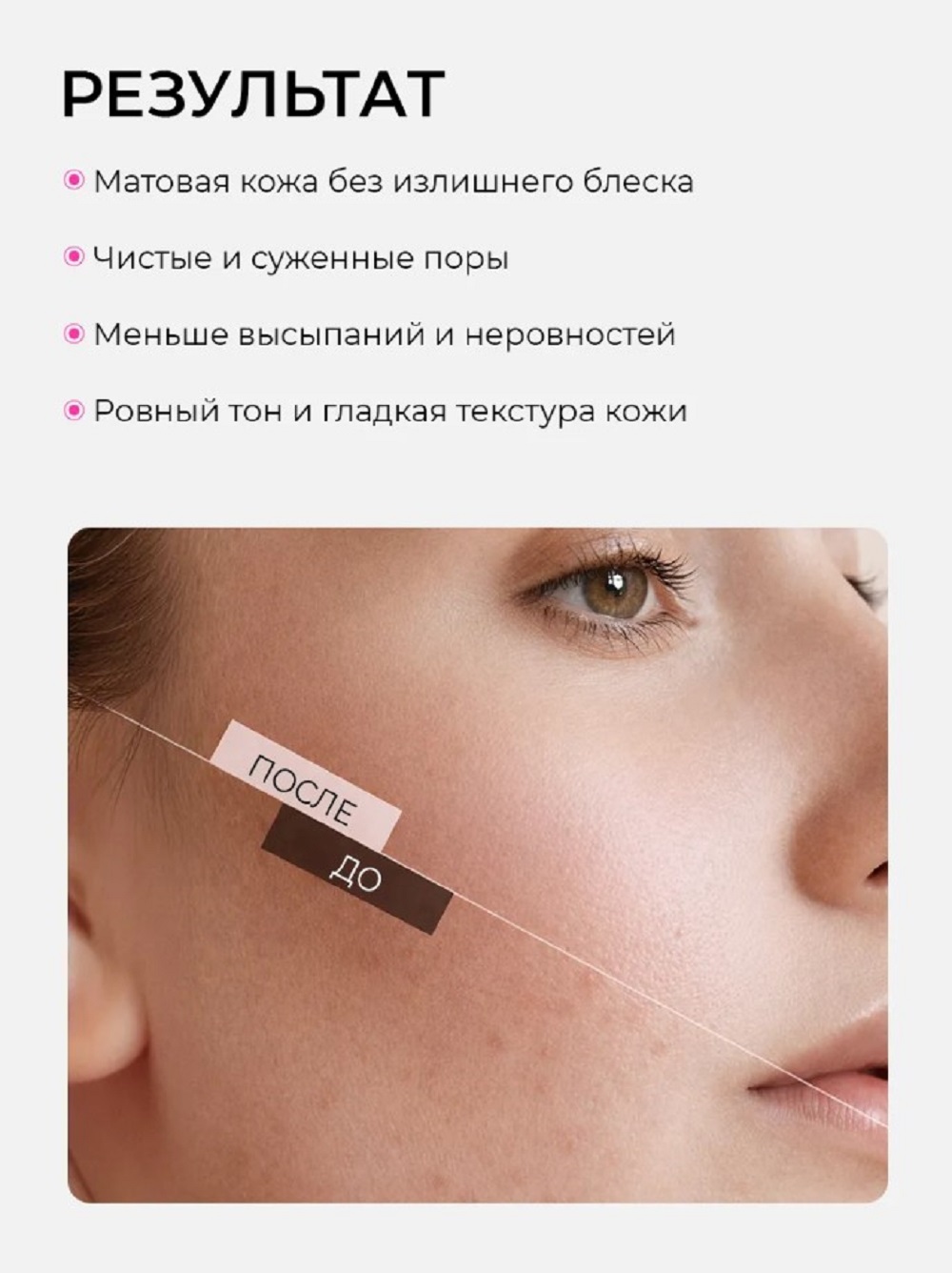 Крем SHARY для проблемной кожи 50 г - фото 3