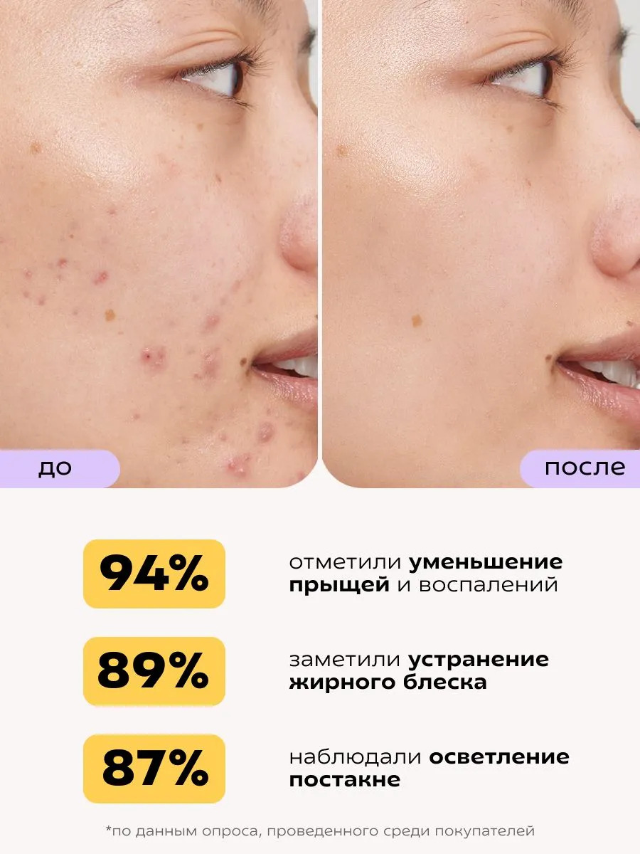 Сыворотка Краснополянская косметика Муцин и Ниацинамид 30 мл 2 шт. - фото 8