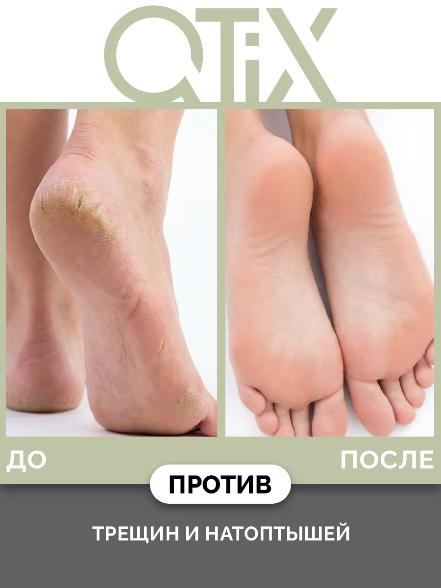 Крем Qtix - фото 7