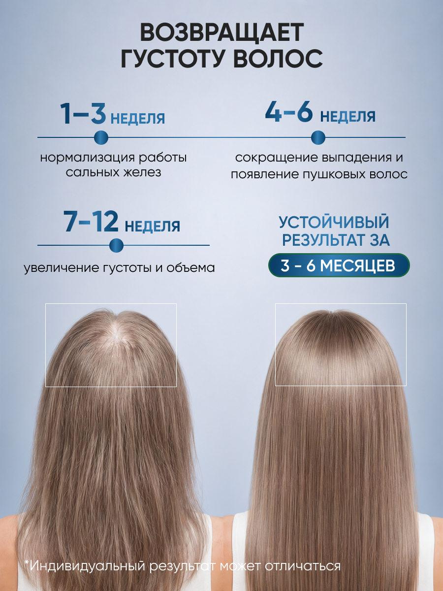 Спрей Ринфолтил От выпадения Для жирной кожи 100 мл - фото 5