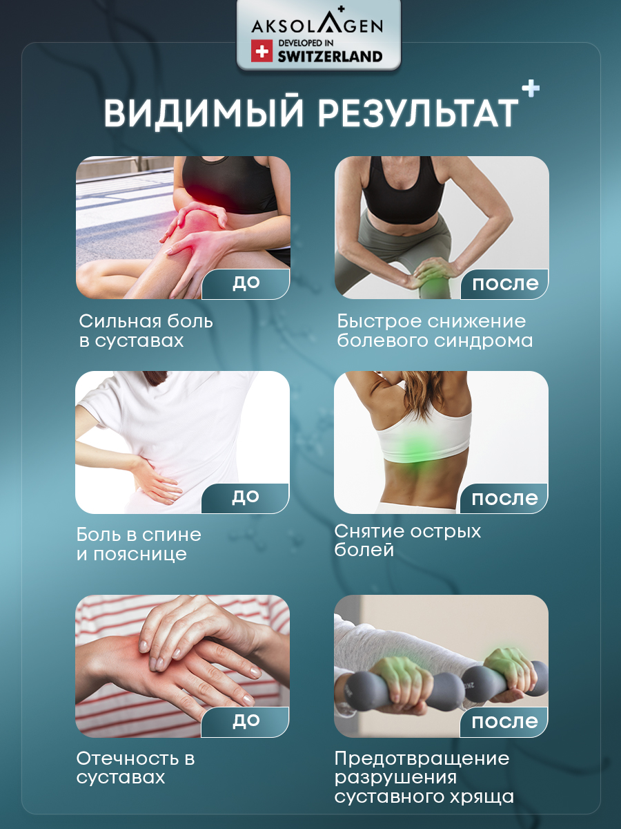 Морской Коллаген 2 типа AKSOLAGEN защита суставов и связок без добавок - фото 9