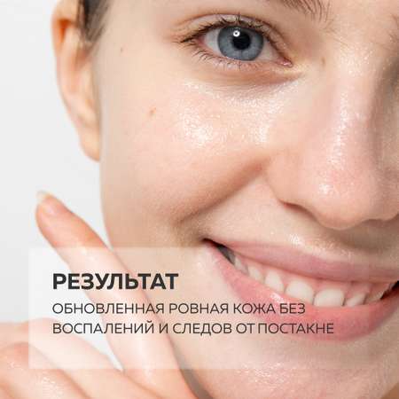 Пилинг Green Mama PROFESSIONAL FORMULA 30 мл