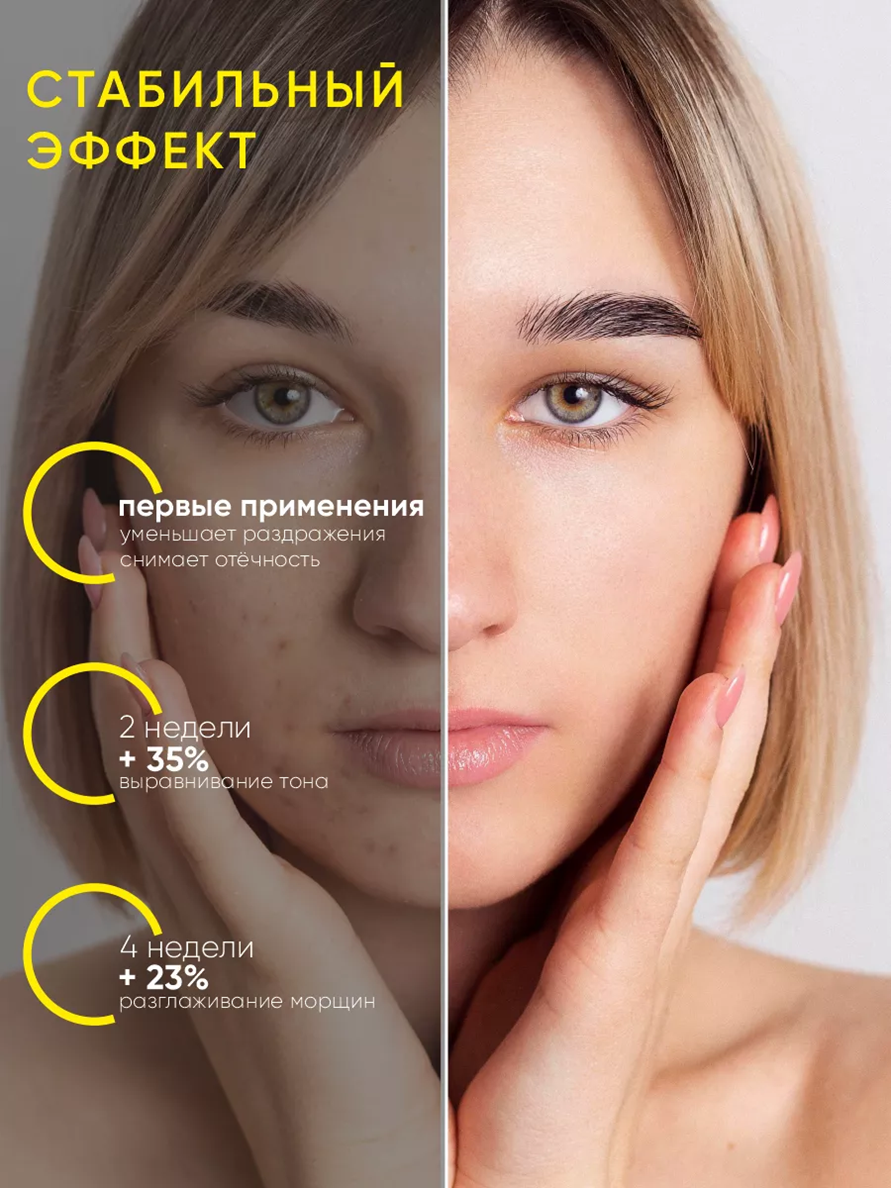 Сыворотка ONESS SPORT - фото 5