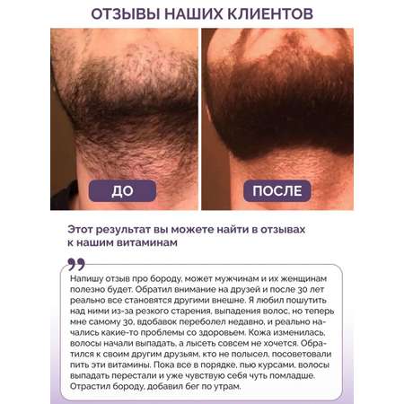 Витамины для волос кожи ногтей BIOTTE hair nails skin витаминно-минеральный комплекс БАД 60 капсул