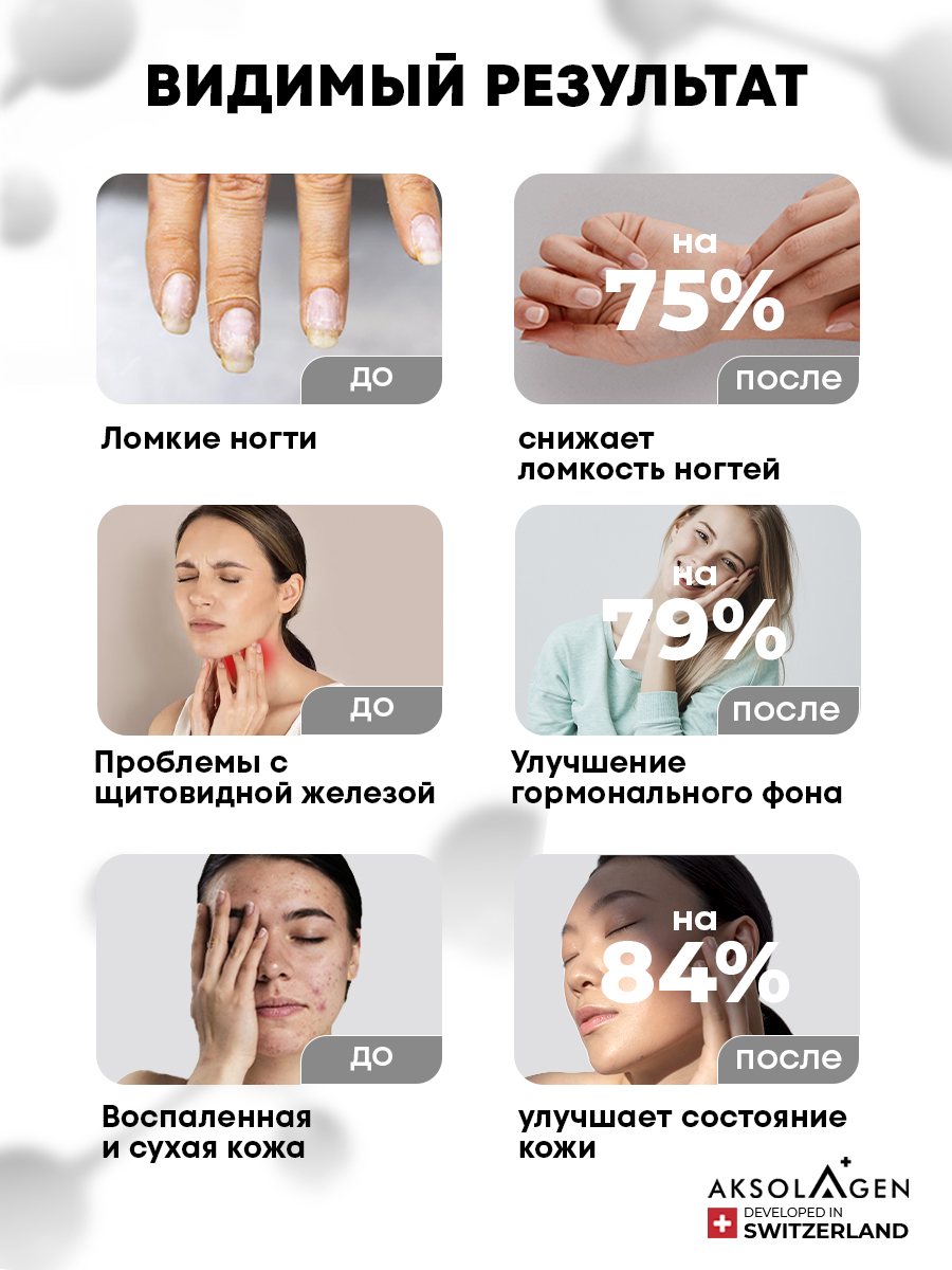 Морской коллаген 1 2 3 типа AKSOLAGEN с экстрактом кокосового молока - фото 2