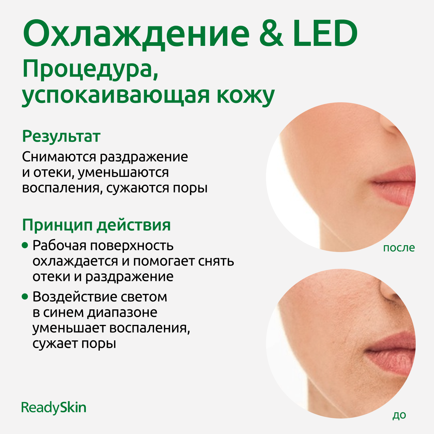 Аппарат для омоложения ReadySkin Eva - фото 9