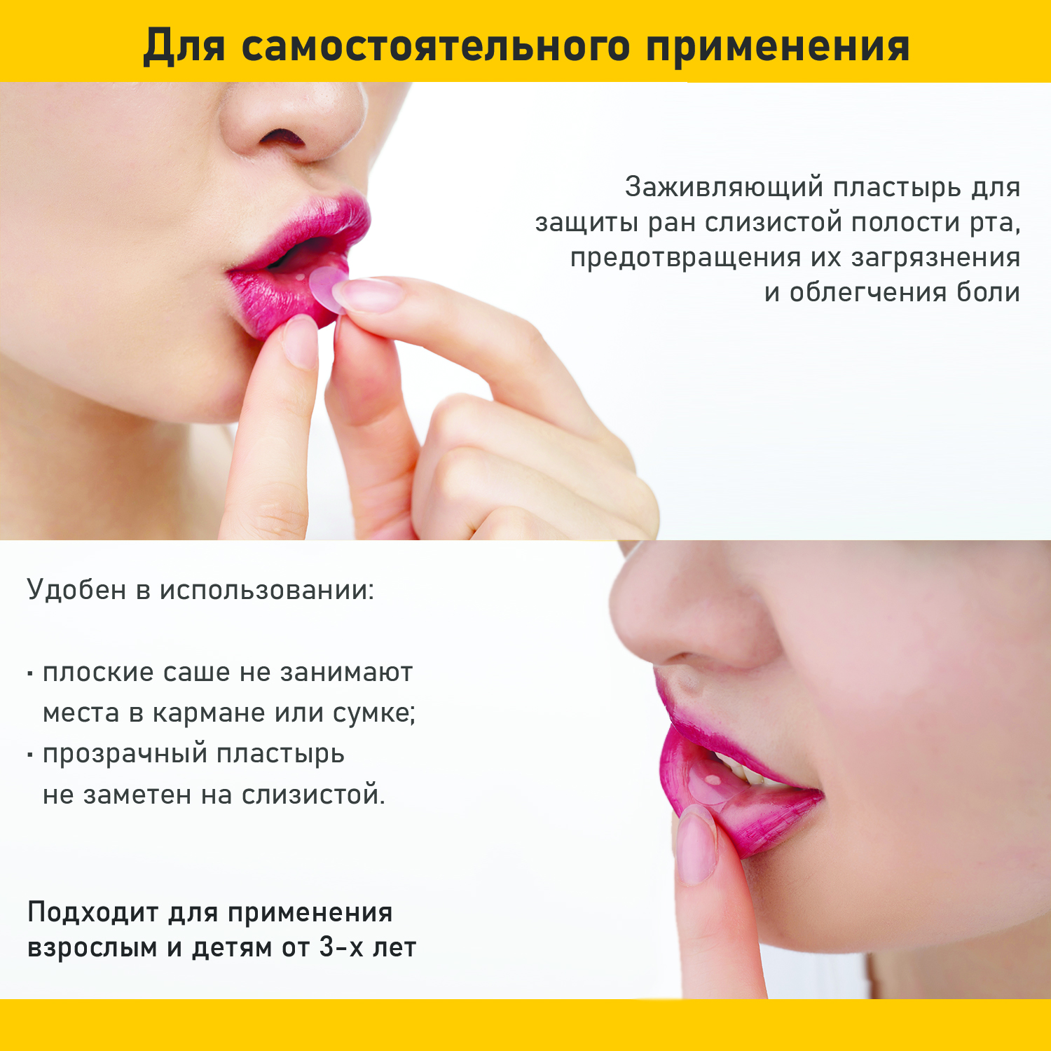 Набор заживляющих пластырей Curatick для полости рта (2+2шт) - фото 4
