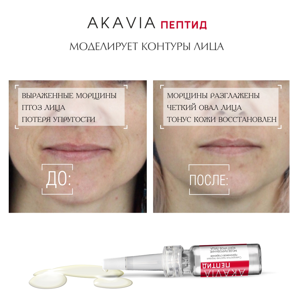 Сыворотка АКАВИЯ Peptide Моделирование - фото 7