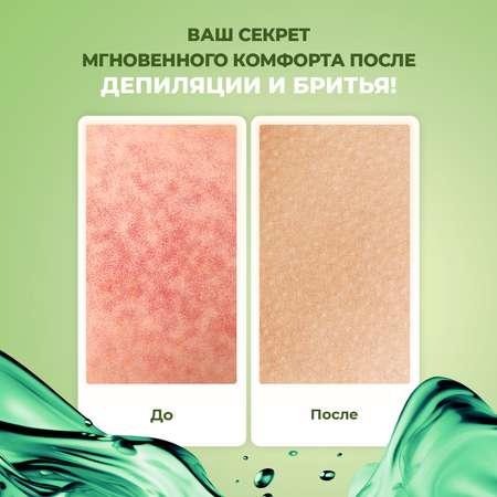 Крем-гель от раздражения YesMix после депиляции, 250 мл