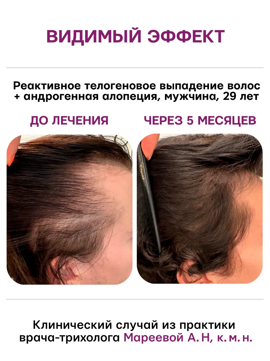 Сыворотка Селенцин 100 мл 1 шт. - фото 10