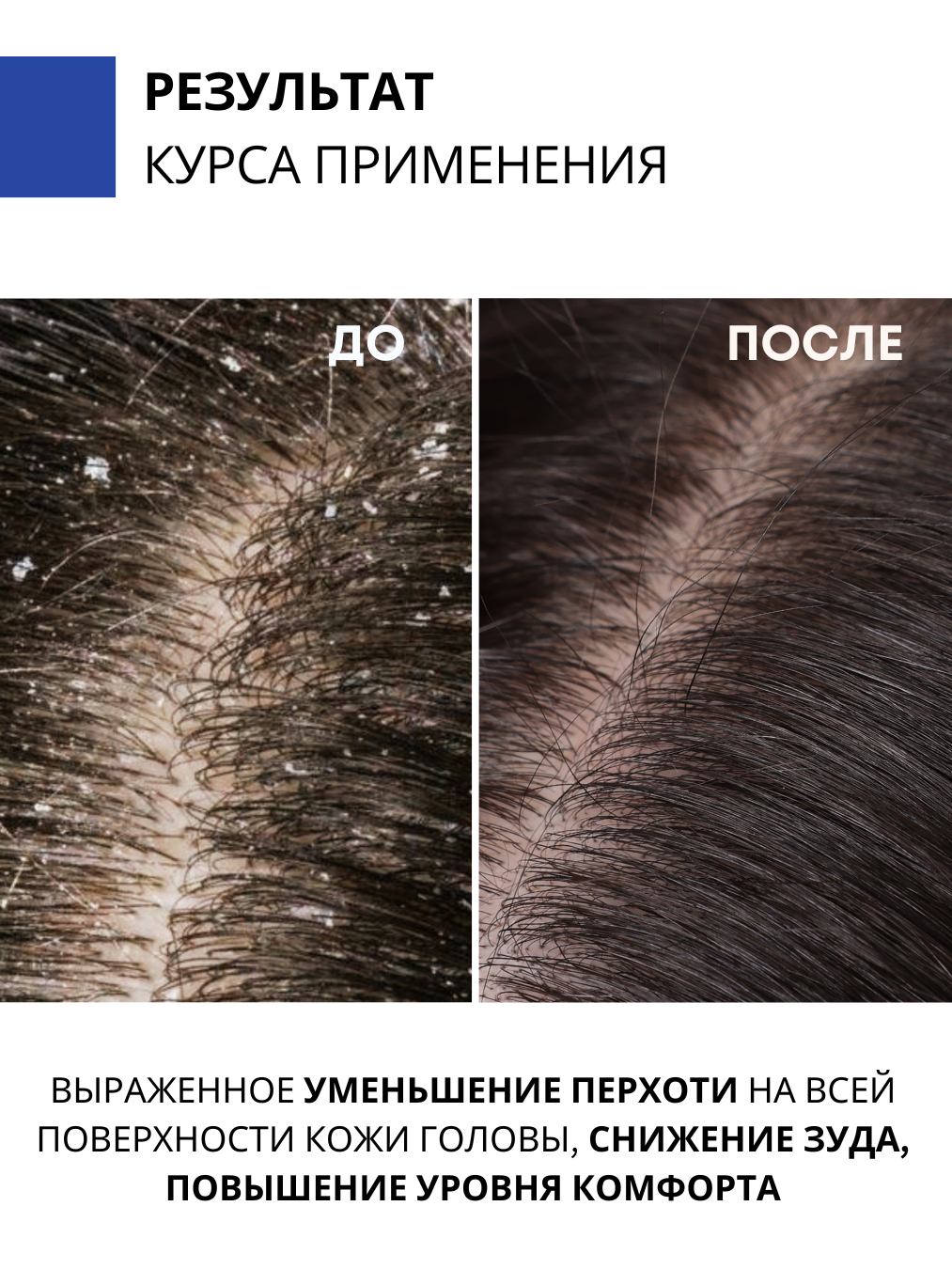 Шампунь DR. MARCUS HEILER 250 мл - фото 6