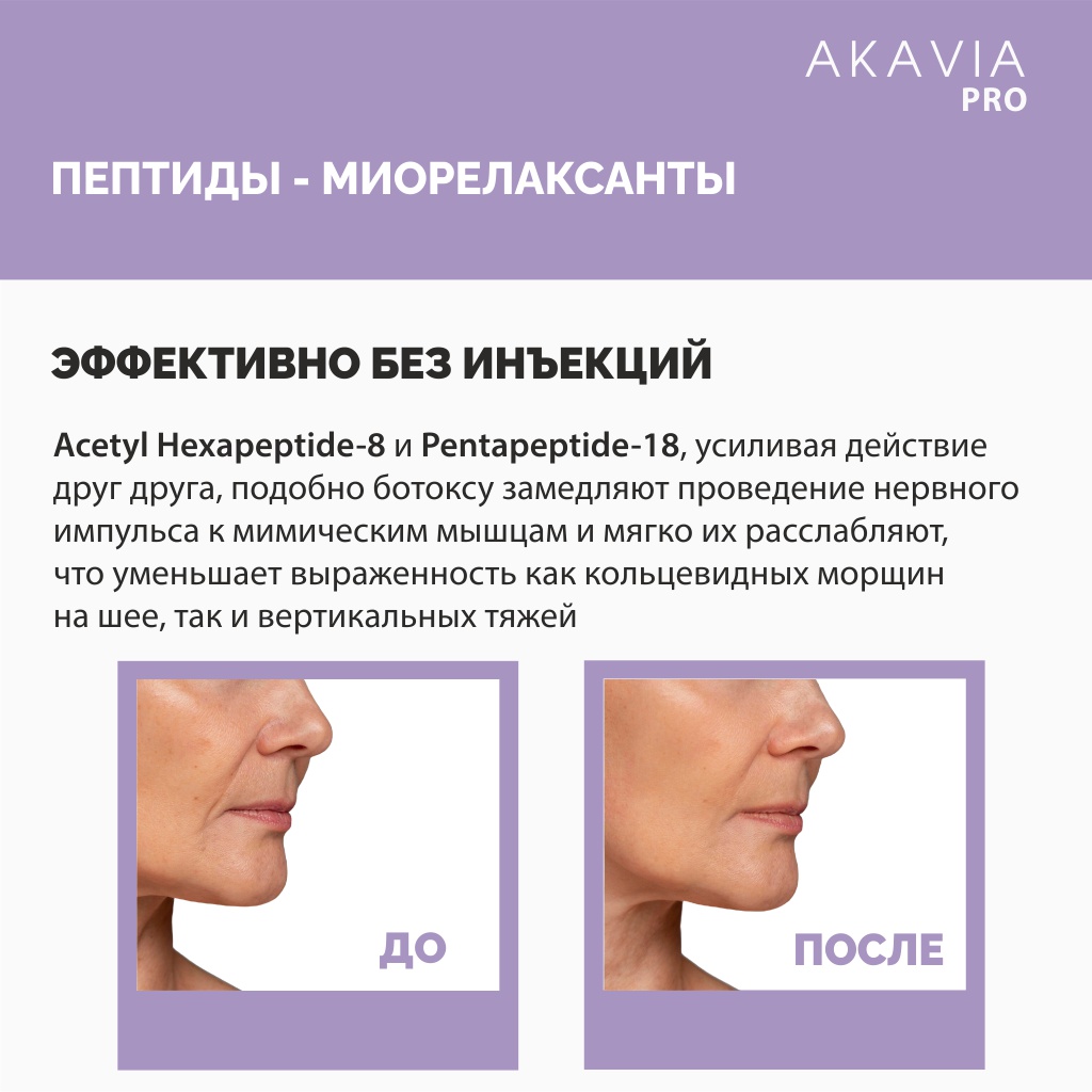 Сыворотка АКАВИЯ Для лица, шеи и зоны декольте - фото 4