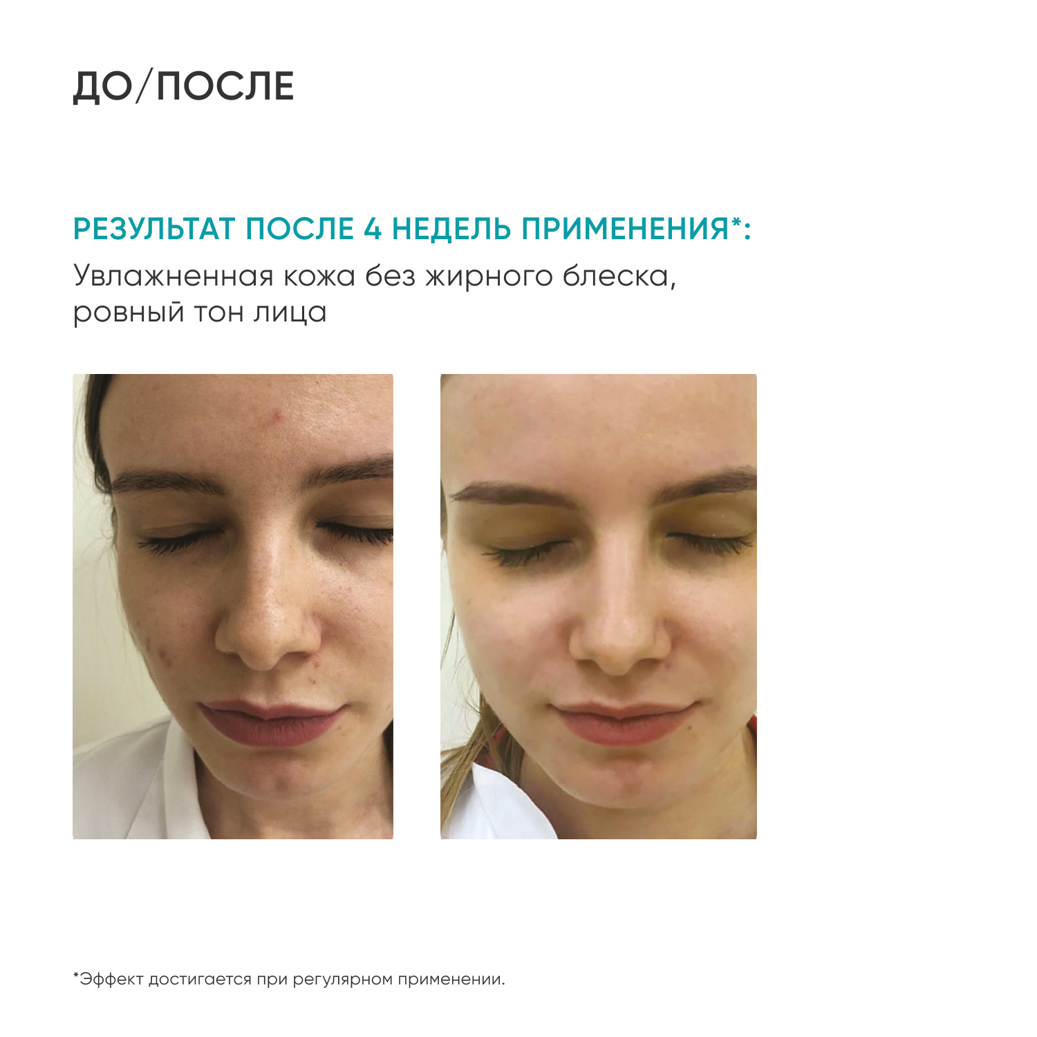 Набор косметики ICON SKIN для ухода за комбинированной и нормальной кожей re balance - фото 3
