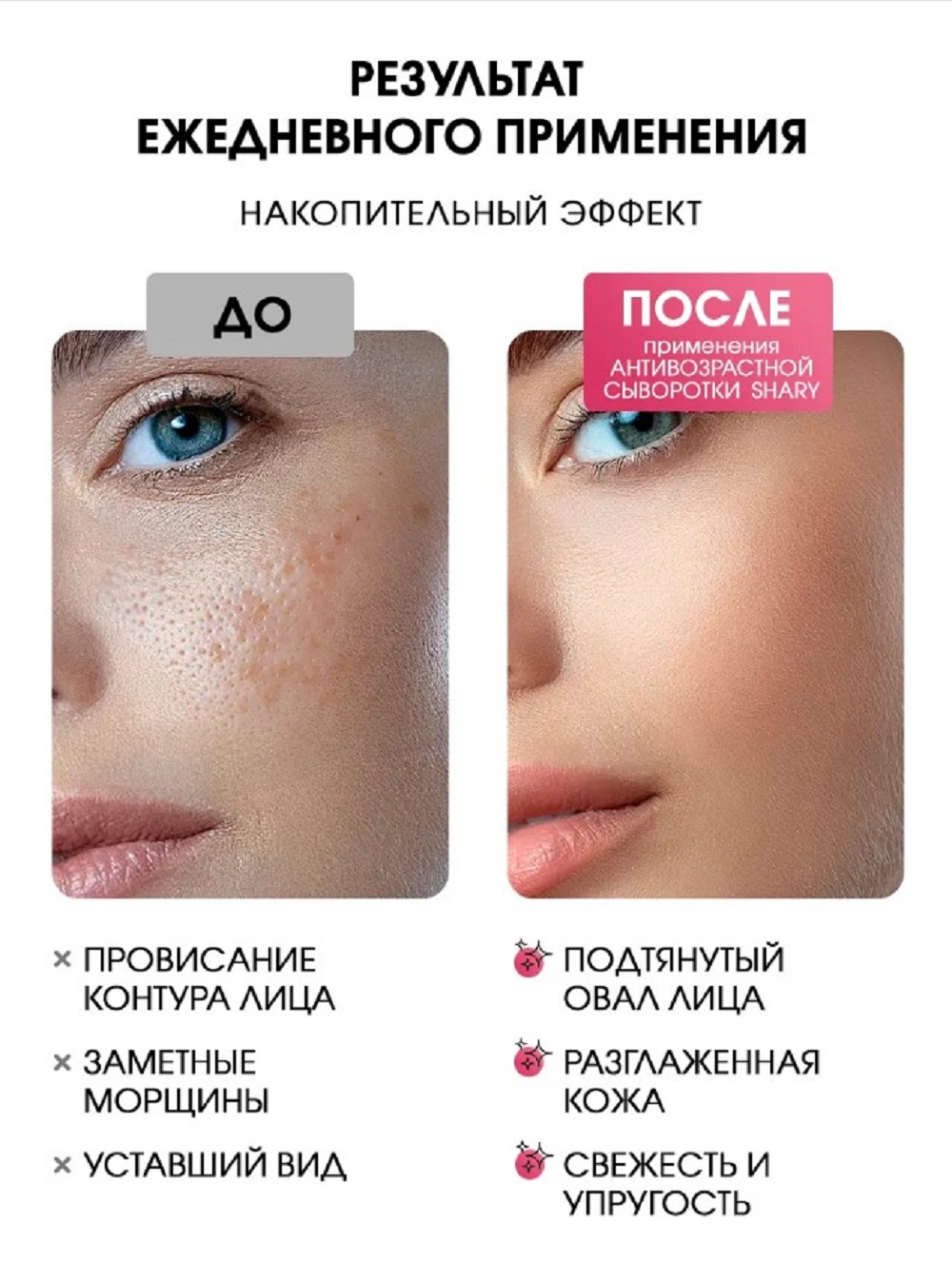 Сыворотка SHARY Perfect Skin с коллагеном 30 мл - фото 2
