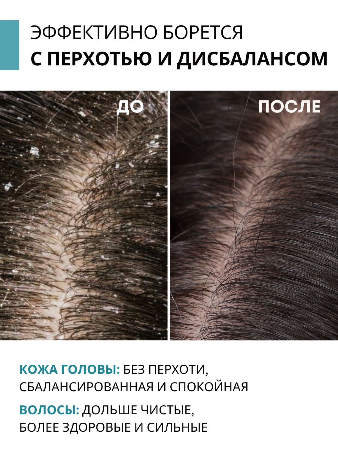 Сыворотка DR. MARCUS HEILER Микробиом баланс от перхоти 100 мл - фото 4