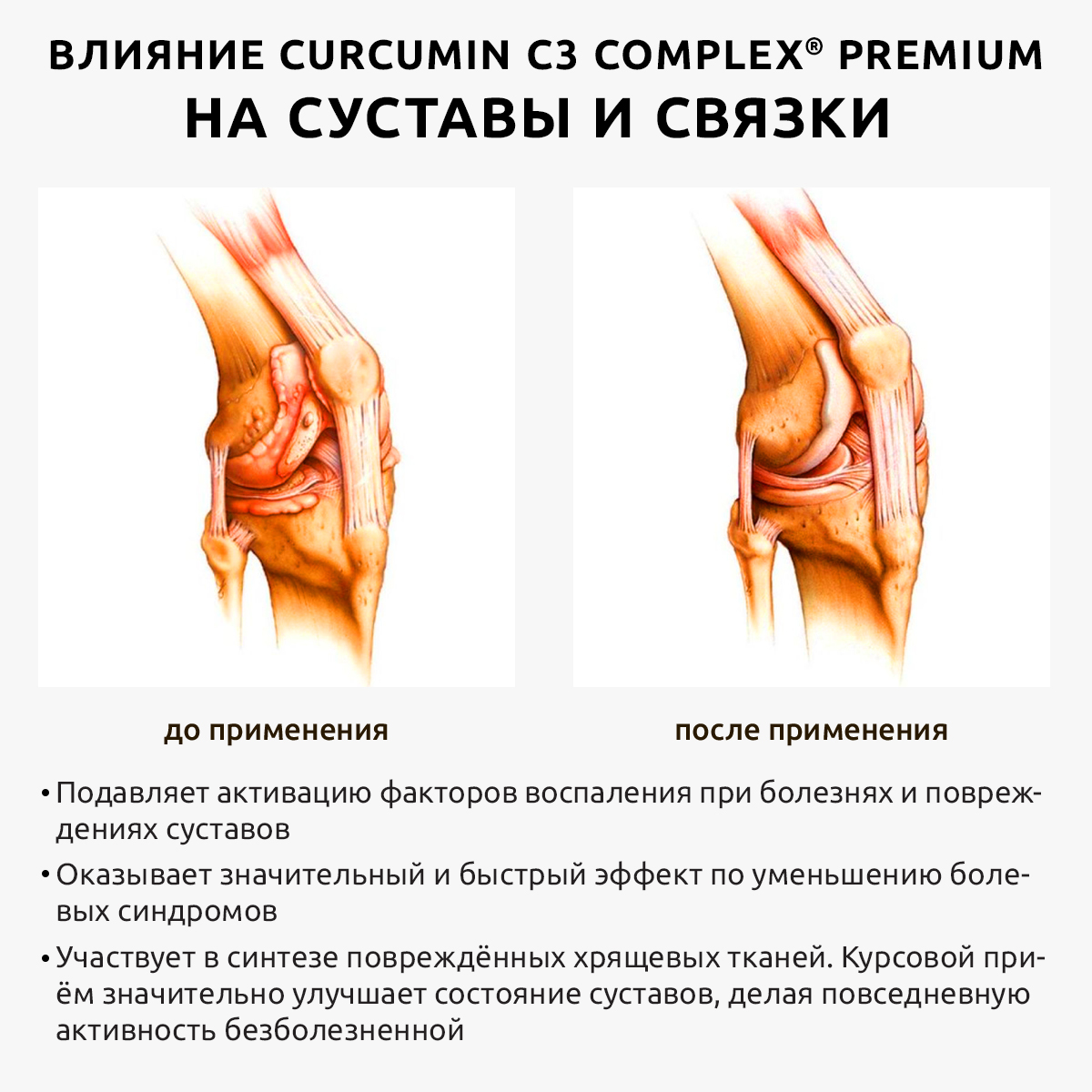 Комплекс для суставов и связок UltraBalance витамины омега 3 с коллагеном и куркумином БАД в капсулах для мужчин и женщин - фото 13
